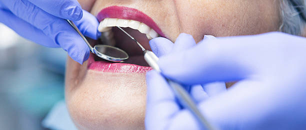 Best Emergency Dentist for Lost Fillings or Crowns in Holly Hill, FL